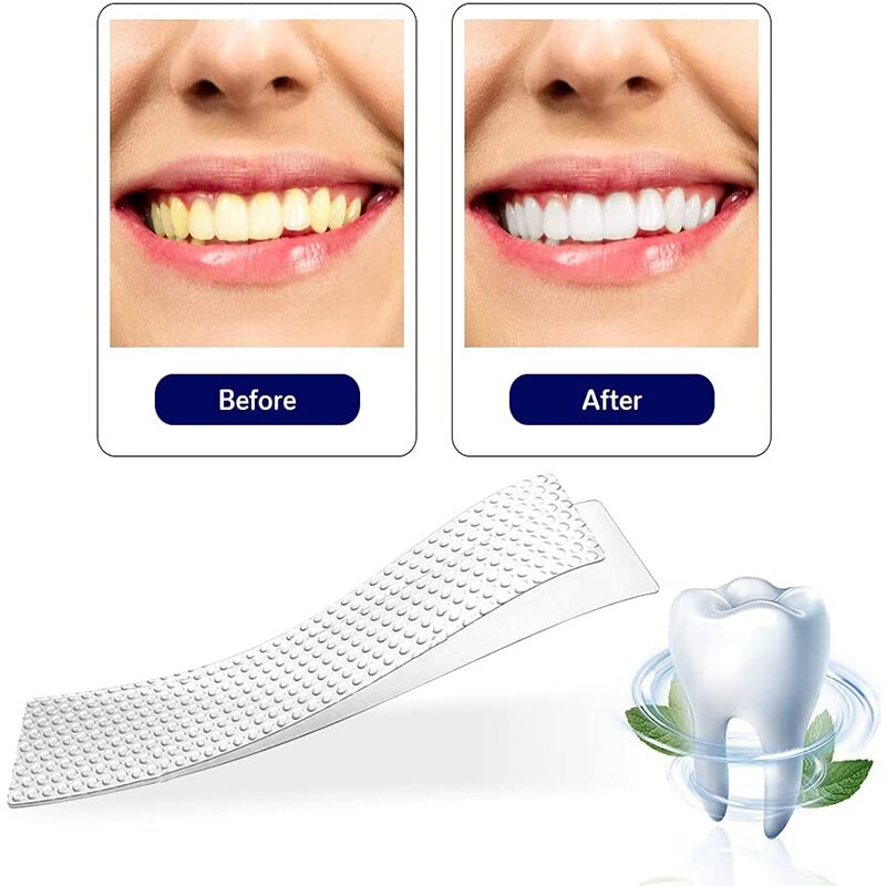 Adesivo Para Clareamento Dental - Clean Mint™️
